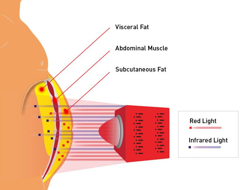 light therapy belly abdomen subcutaneous fat visceral fat