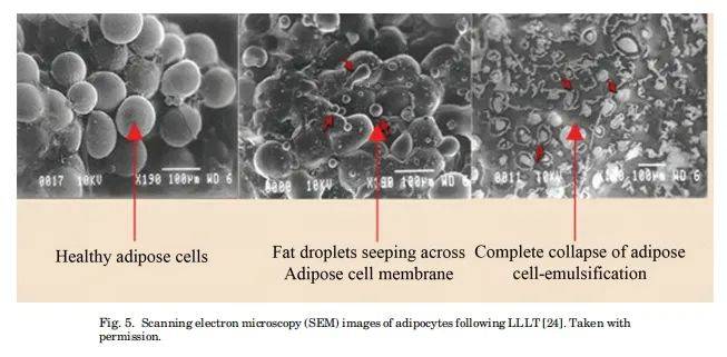 fat cell membrane