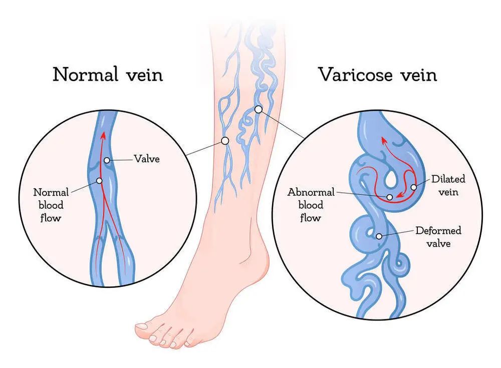 normal vein