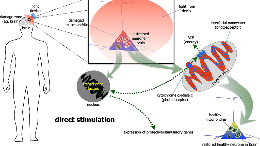 Whole Body Photobiomodulation