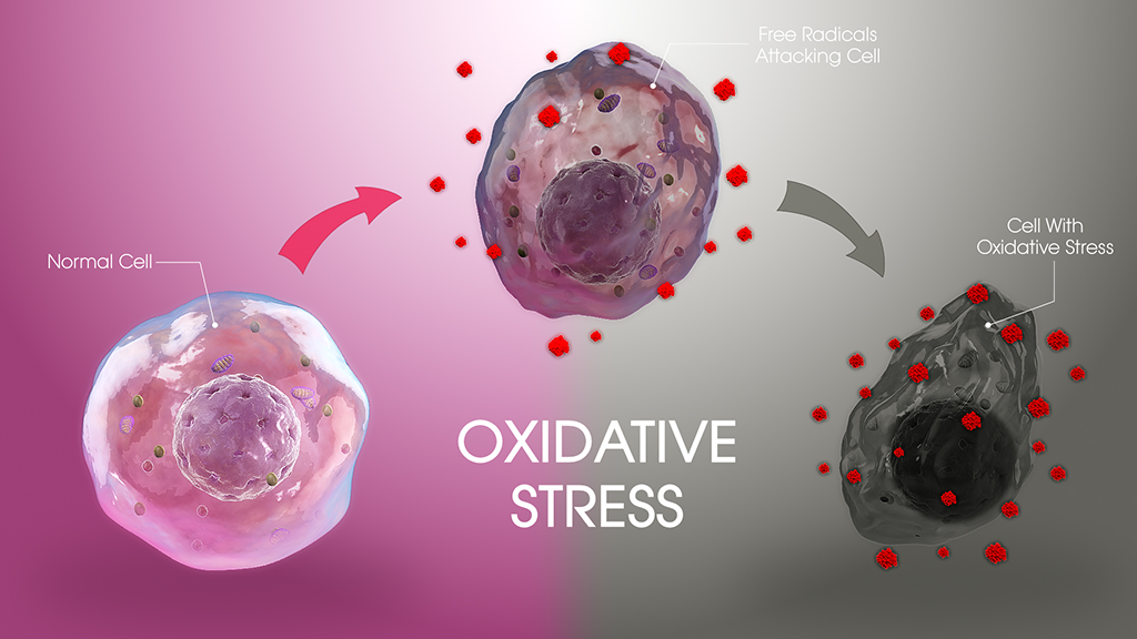 oxidative stress