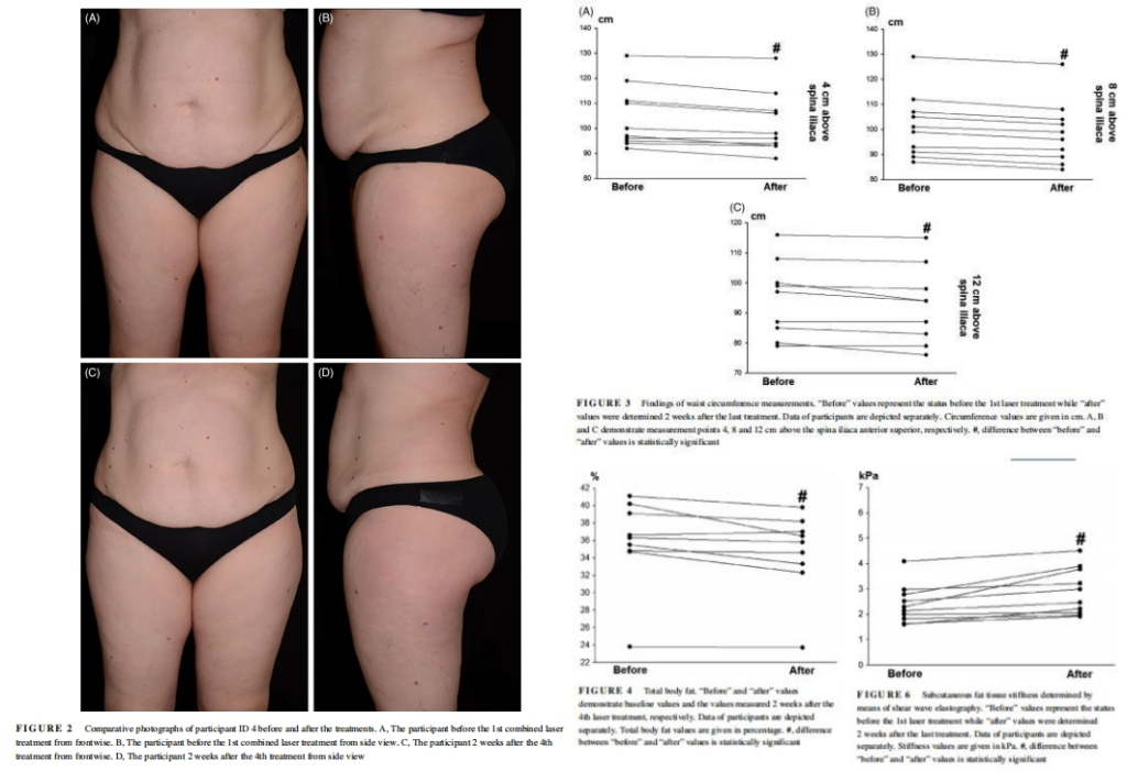 red light therapy post 7