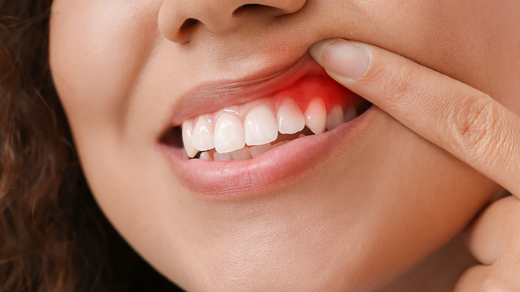 Can red light therapy encourage gum regrowth