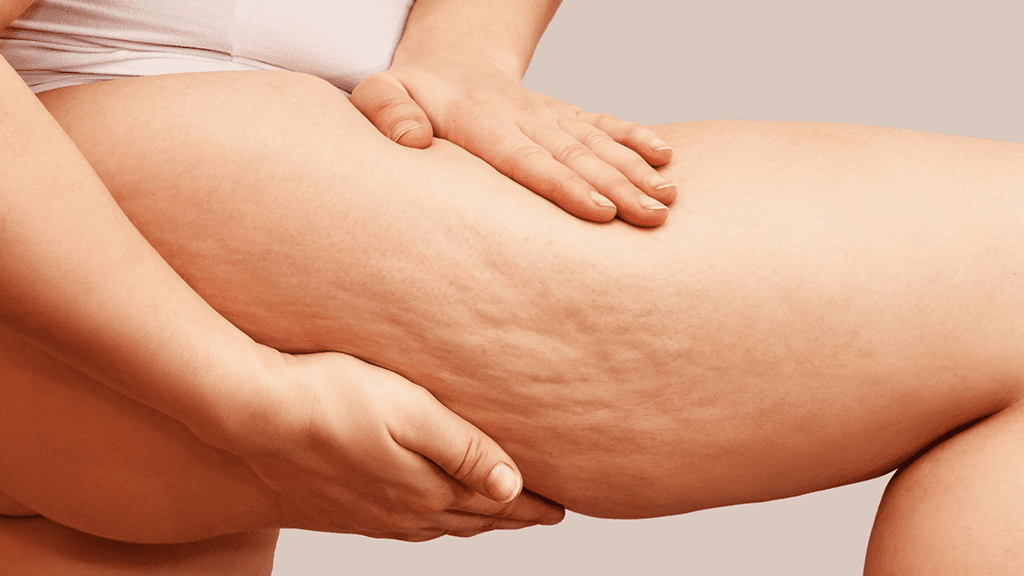 Red light therapy for reducing cellulite
