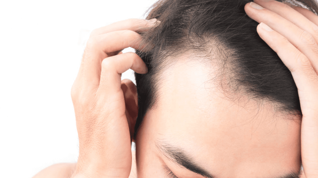 LLLT Laser Hair Loss Treatment A Safe, Proven Solution for Thinning Hair