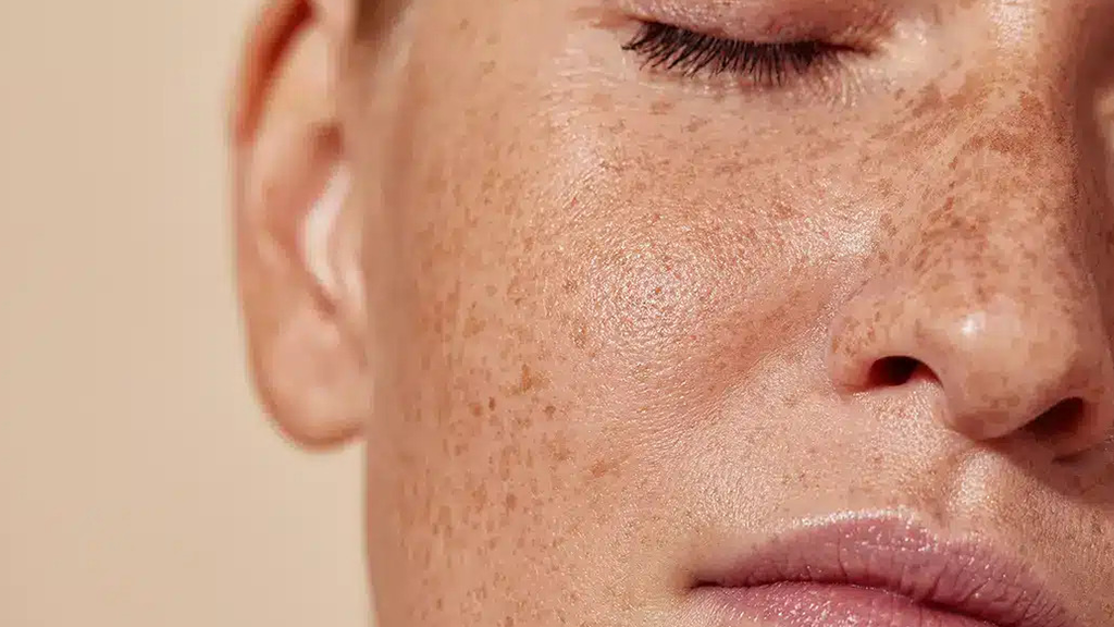 10 FAQs About Red Light Therapy for Dark Spots